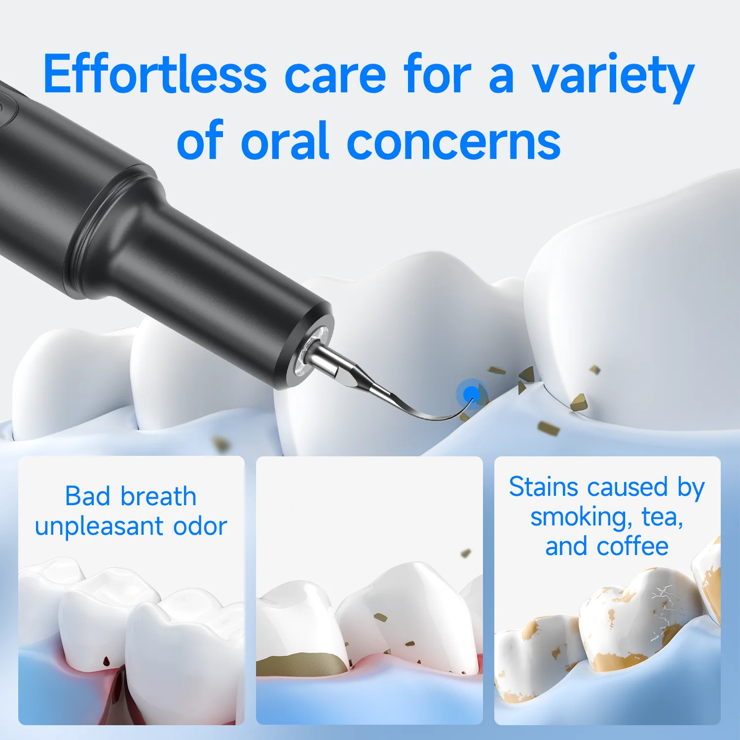 Thumbnail 2 - #30 Highest Rated Ultrasonic Scalers to Buy in 2026
