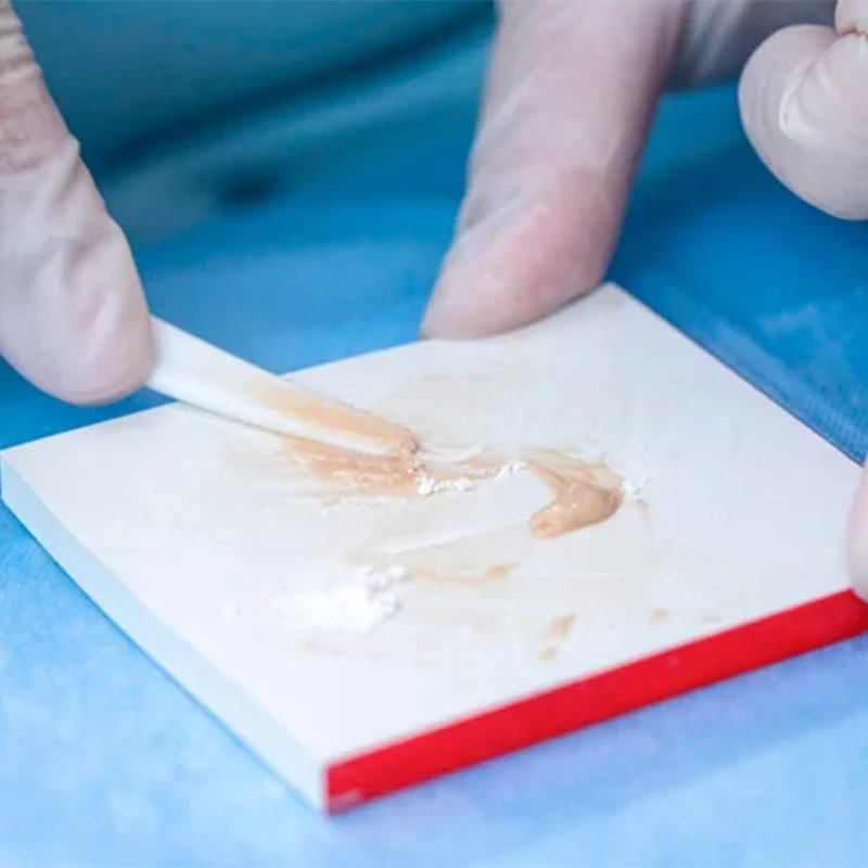 Рисунок 6 - VVDental стоматологический стеклянный тонометр