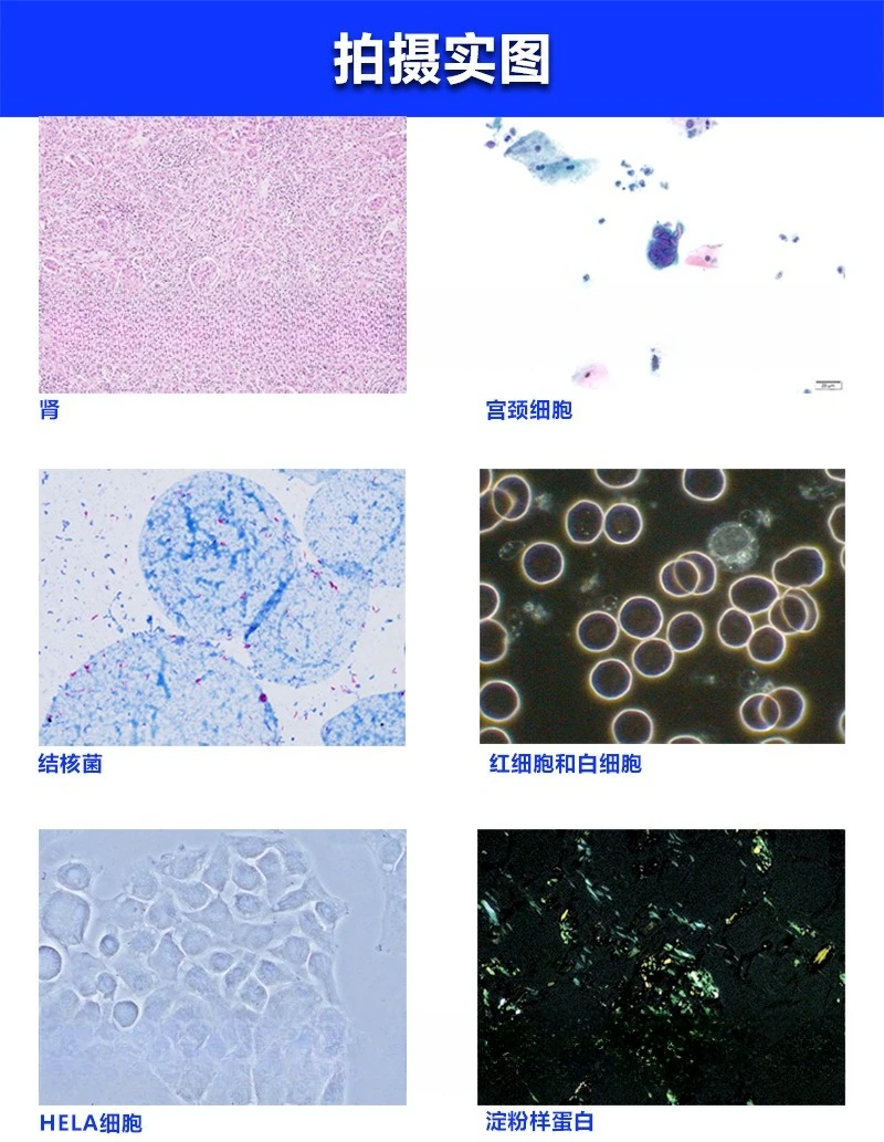 Microscópio biológico, microscópio trinocular binocular, microscópio fluorescente