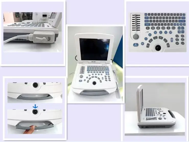 EURPET Cheap Medical Table Top Ultrasound Scanner System Ultrasound Machine With Probes Price