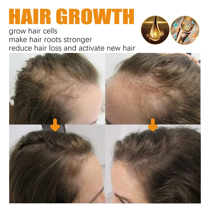 Biotin Fast Hair Growth Shampoo Anti Hair Loss Serum Scalp Treatment Prevent Alopecia Baldness Conditioner Hair Care Products