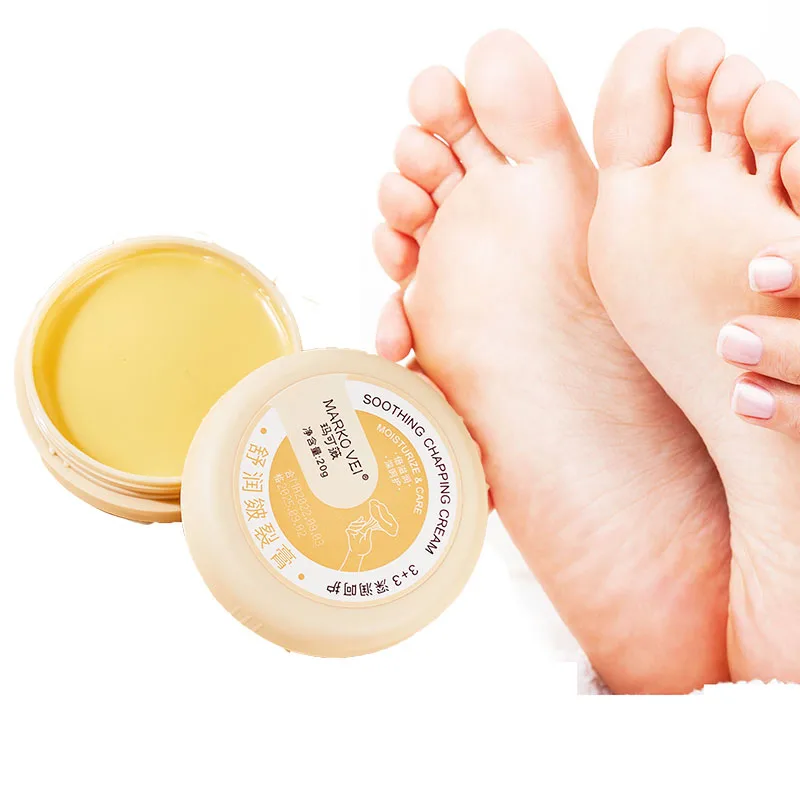 Crème anti-séchage et anti-Contation pour les pieds, réparation des fissures au talon, hydratant, élimination de la fréquence, peau, main, gerçures, soins de la peau, 20g