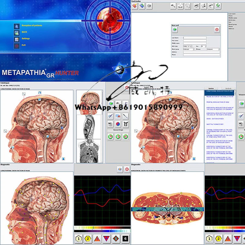 

Earphone Handset Metatron Meta 18D Hunter 4025 Health Scan Nls the Quantum Therapy Analyzer for Body Health
