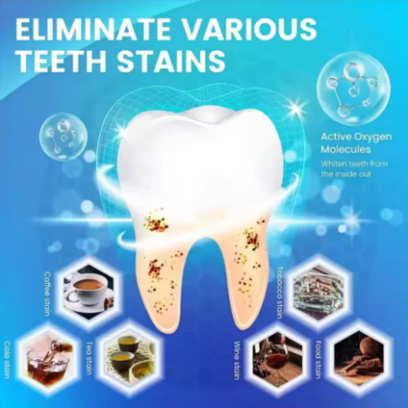 14/28/70 pz mix 3D/5D/9D Gel S - Whitening Strip 3D recensione e prezzo