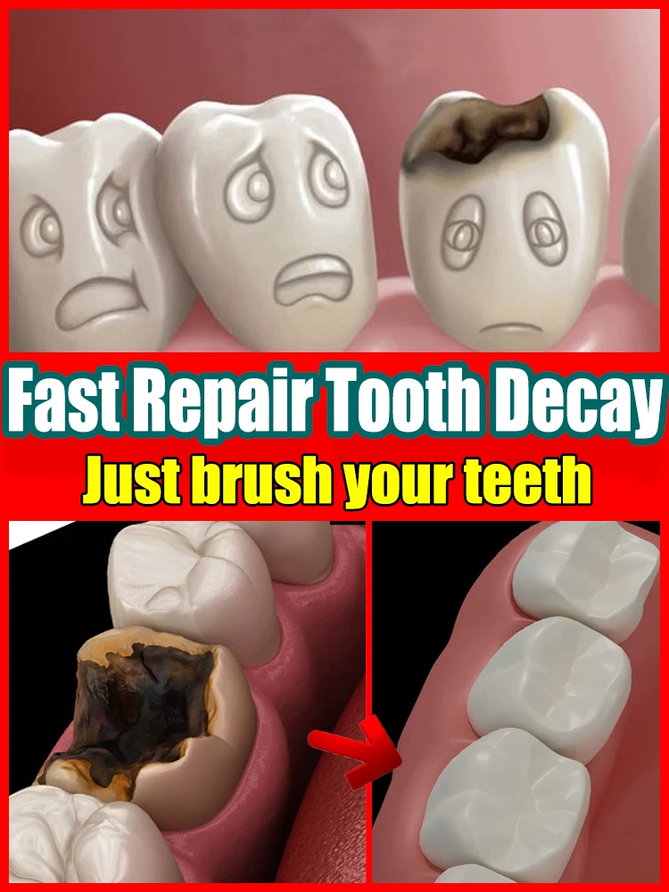 tooth decay repair cavities protect teeth