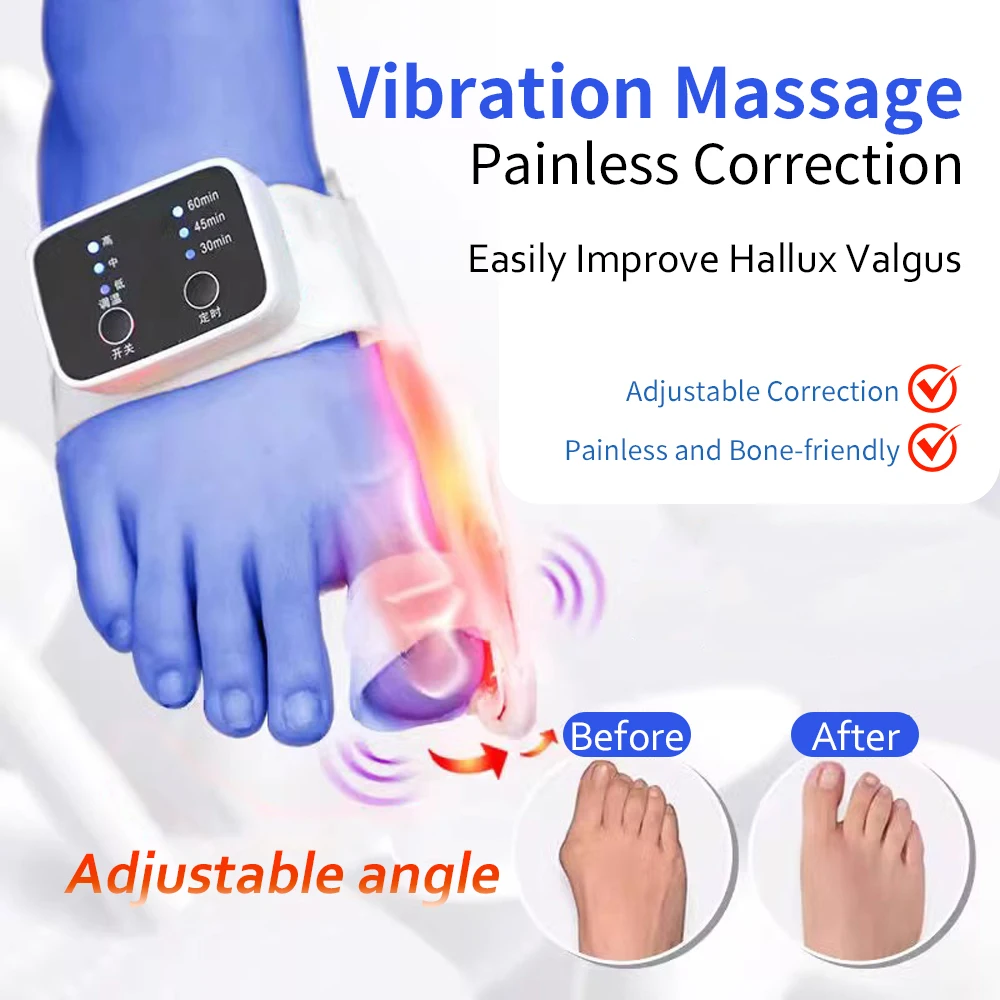 מפריד הבוהן אלקטרו מפריד מחליק מתקן האזה וולגוס וולגוס מגן הבוהן אורטוטיקה braces bunion