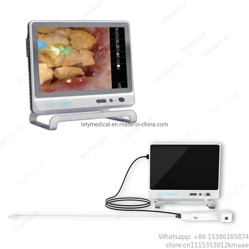 Vequyn Single-Use Flexible Video Ureteroscope, Digital Disposable Urethro-Renoscope, High-Quality Urology Device
