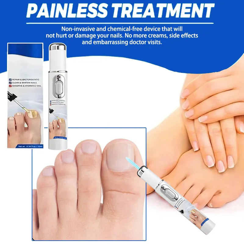 

Инструменты для ремонта грибка ногтей на ногах, лечение грибка ногтей, лазерная ручка, лазерное лечение онихомикоза, безопасный безболезненный ремонт ногтей