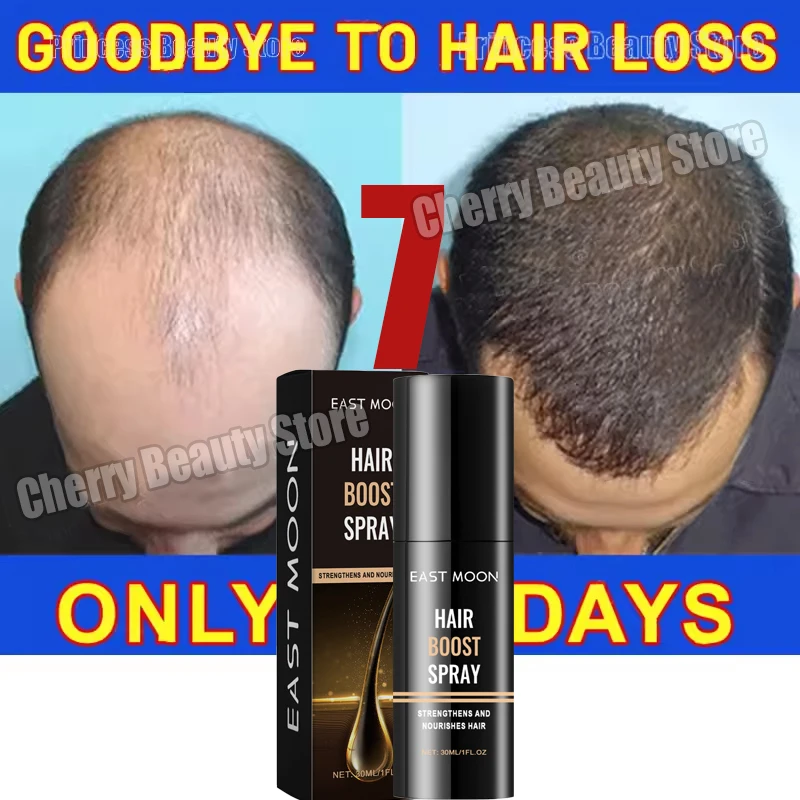 

7-дневный спрей-сыворотка для роста волос, быстрая способность роста волос, средства против выпадения волос, восстановление кожи головы, облысение, питание, уход за корнем волос