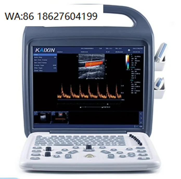 Multifunctional Digital Black White Ultrasound Scanner Dogs Adjustable Veterinary Echocardiography Laptop Reusable DCU10