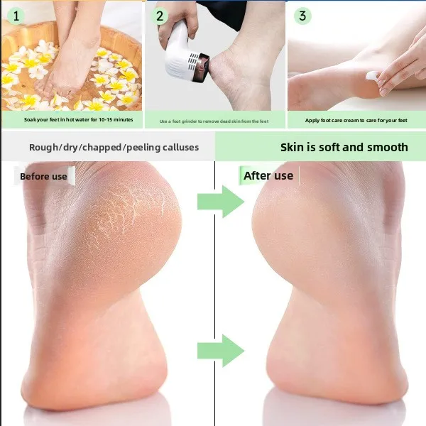 Electric Foot File with Battery Display Rechargeable Type-C Waterproof Anti Splinter Dead Skin Remover Pedicure Tool for Women