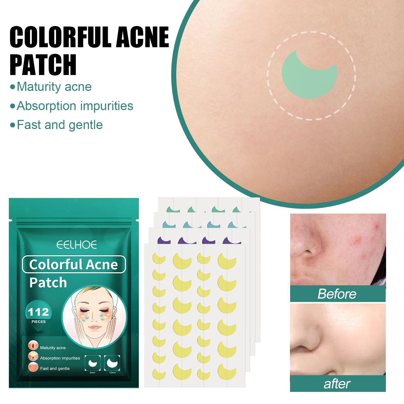 Patchs Acné Zit en Forme de Lune, Autocollant Hydrocolloïdal Coloré pour la Guérison des lèvent, Absorption de Bain, pour la Plupart des Peau