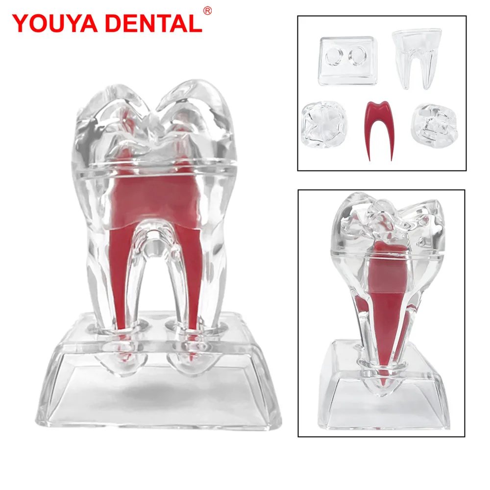 Dental Anatomical Model Transparent Tooth Disintegration Model Dental Anatomy Detachable Teeth Model Dental Anatomical Structure