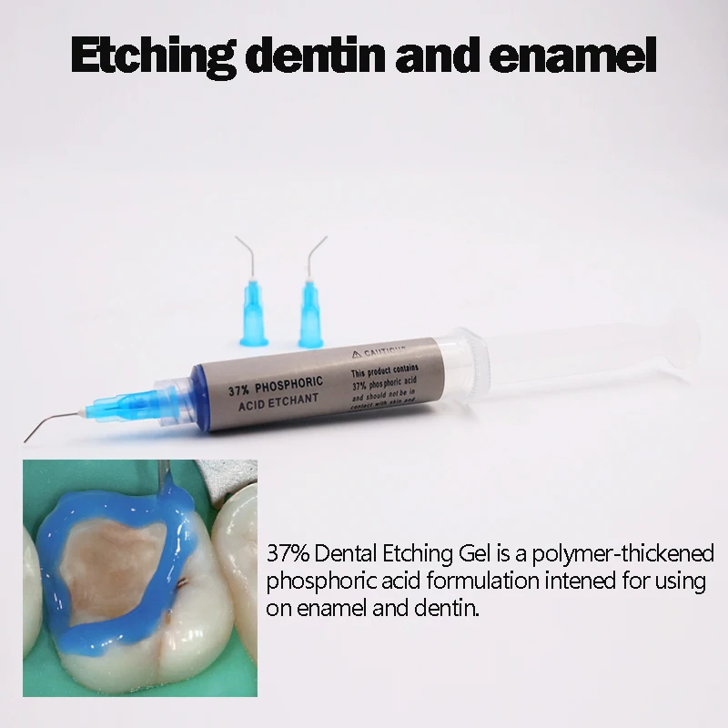 Gel de grabado azul de ácido fosforico 37% Dental para tratar el esmalte de la dentina, grabado modificado, pretratamiento, herramienta de dentista