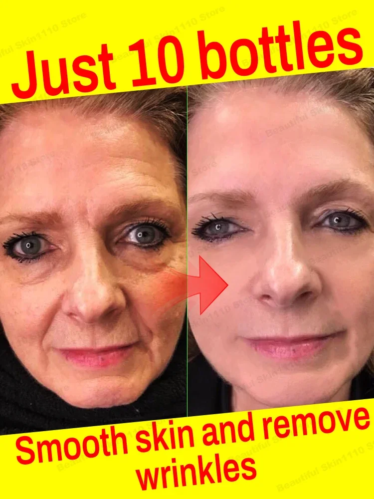 Powerfully achieves youthful skin，Aɴᴛɪ-ᴡʀɪɴᴋʟᴇ Iɴsᴛᴀɴᴛ Rᴇᴍᴏᴠᴇʀ Fᴀᴄᴇ Sᴇʀᴜᴍ Lɪғᴛɪɴɢ Fɪʀᴍɪɴɢ Fᴀᴅᴇ Fɪɴᴇ Lɪɴᴇs Aɴᴛɪ-ᴀɢɪɴɢ Essᴇɴᴄᴇ Wʜɪ