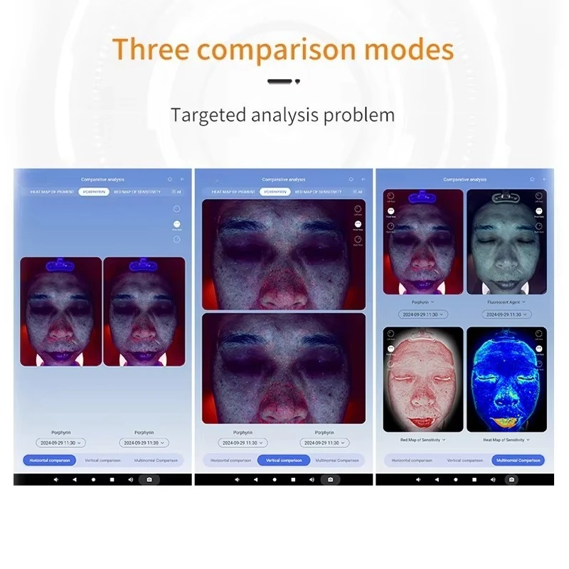 AI Magic 3D Mirror Skaner Twarzy Analizator Skóry Akne Analiza Skóry Analiza Zmarszczek Skórnych Urządzenie Testujące