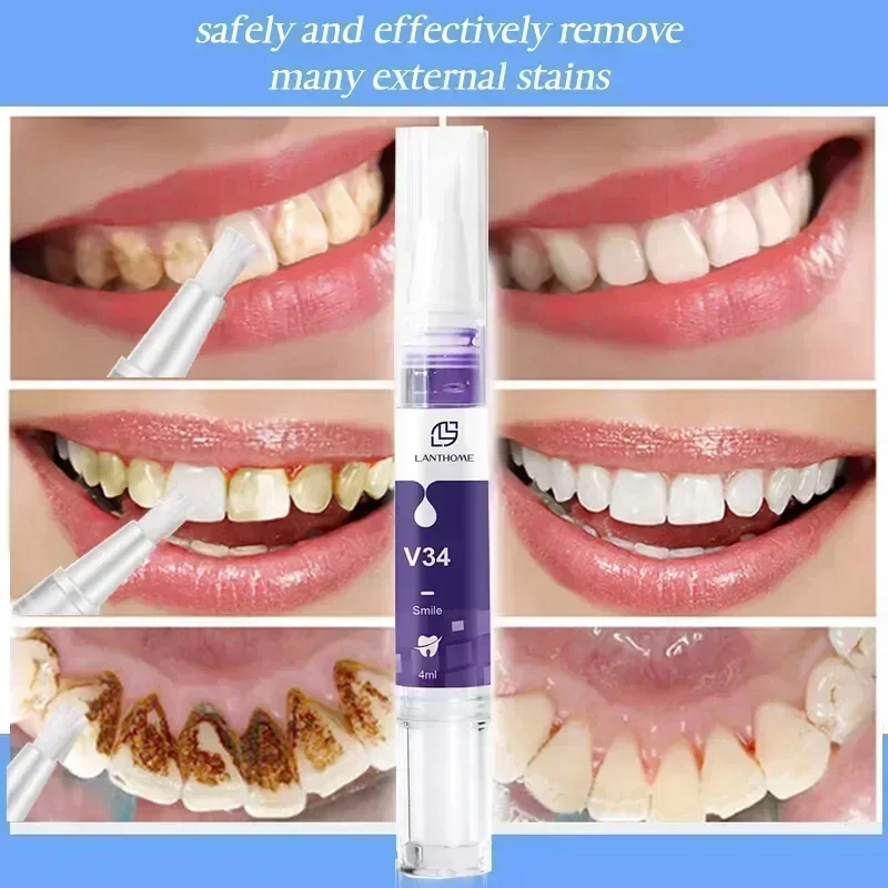 Dentes Whitening Creme Dental Pen, Iluminar Soro Limpo, Removedor de Manchas, Viagem Partable, Cor Roxa, V34