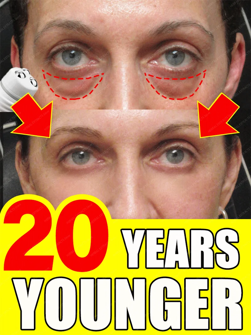 

remove dark circles