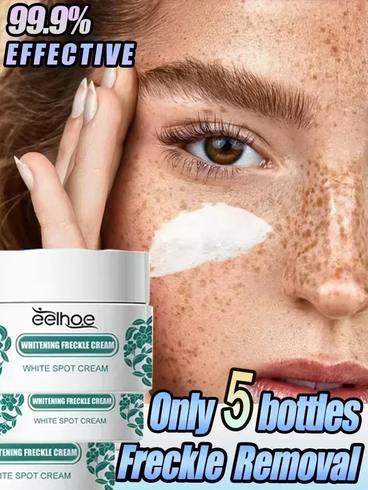 

Removal Dark Spots Freckles Brighten Facial Skin Firming Whitening Frckle Cream Products Reduce Melanin Lighten Dark Skin