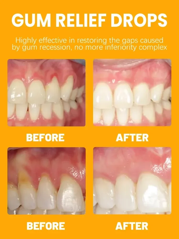 Rapid Repair Gums Serum Effectively Relieve Tooth Allergy Dental Caries Regrowth Drops, Gums For Receding Gums Toothpaste