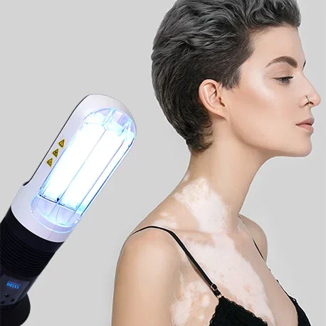 

Clinical use uvb phototherapy device uvb lamp nb uvb uv light phototherapy for vitiligo