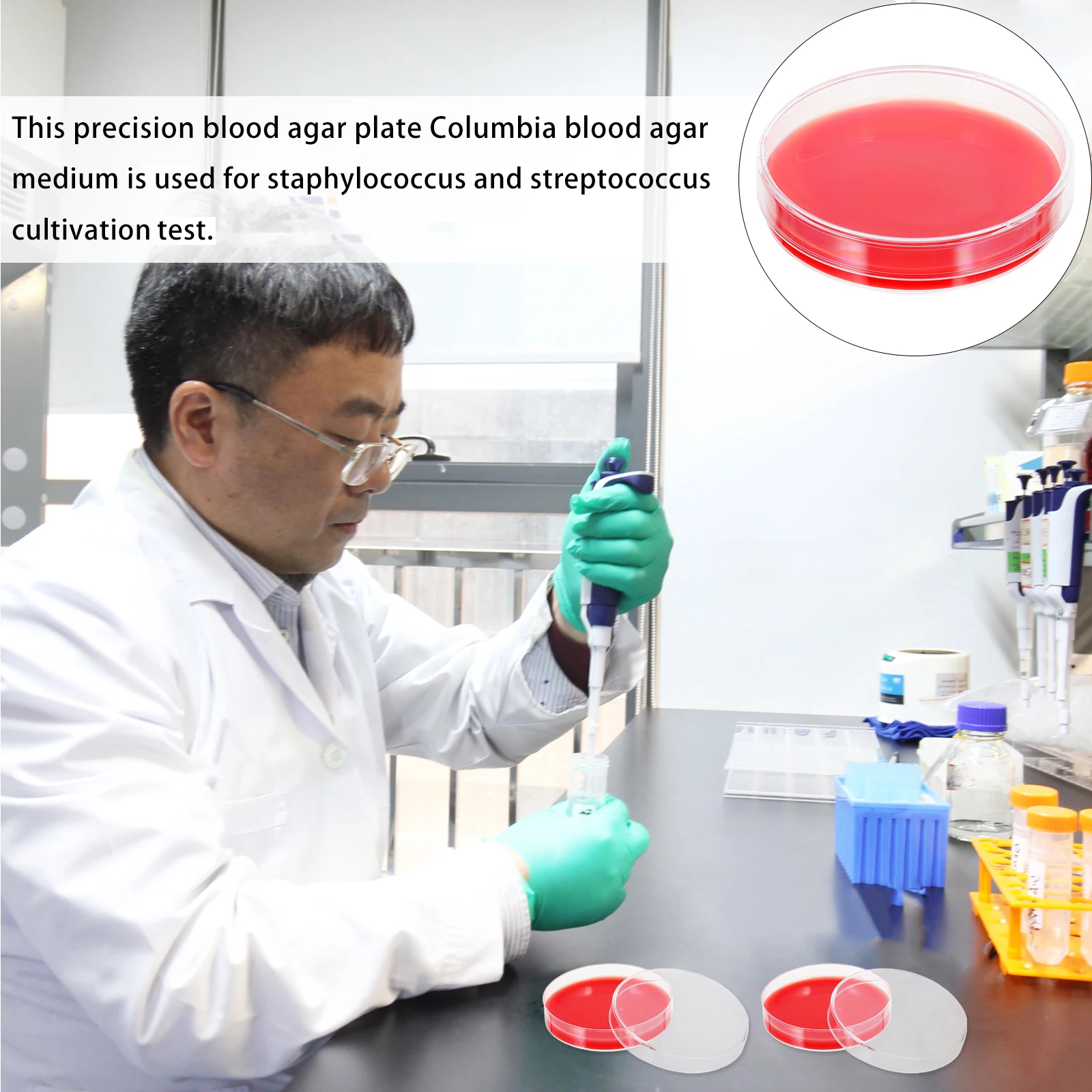

10 Pcs Blood Agar Medium Bulk Plates Lab Science Experiment Nutrient Petri Dish