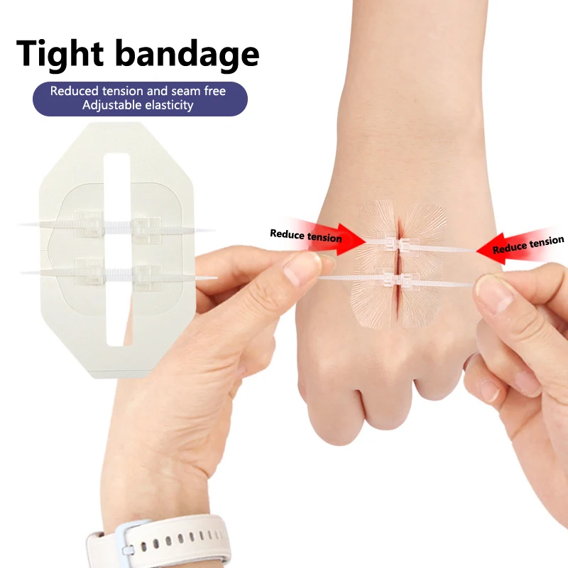 Emergency Wound Closure Zip Stitch Sutures Bandaids Repair Wounds Without Stitches For Outdoor Activities Quick Clot Wound