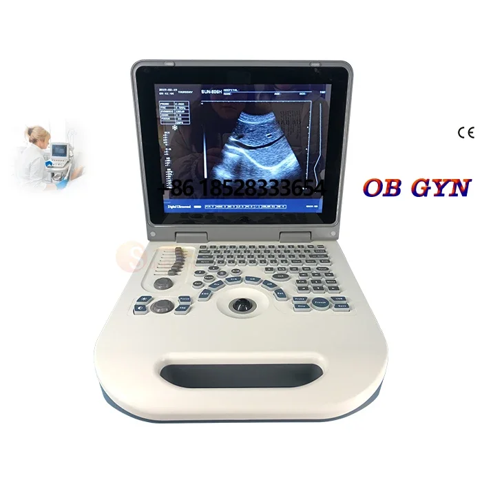 ce cheap ecograph black white ultrasound machine portable medical ultrasound machine set cardiac testing ultrasound