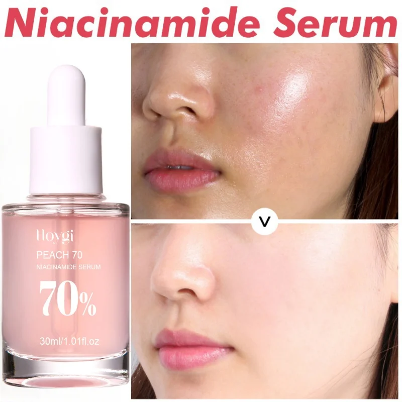 

Peach Niacinamide Essence Fade Fine Lines Facial Serum Women Moisturize Brighten Face Serum Fade Dull Melasma Lighten Skin Care