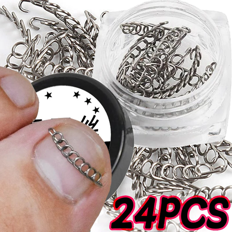 내성발톱 치료 탄성 와이어 고정 스티커, 내성발톱 교정 와이어 복구 페디큐어 도구, 네일 아트, 24 개