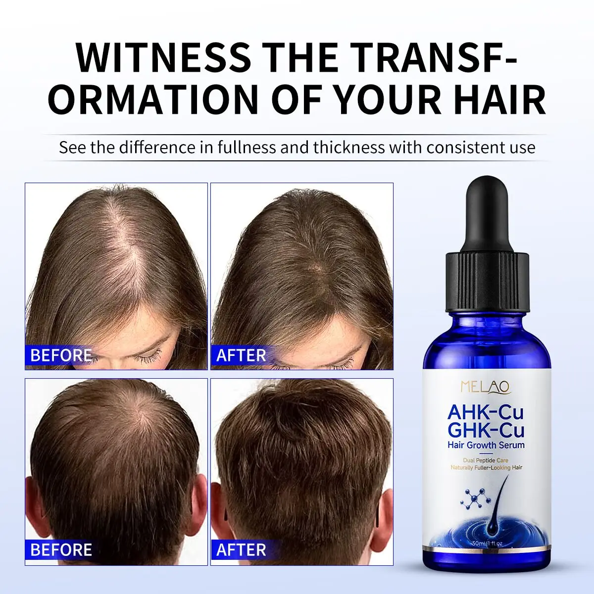 Factory Price 10% GHK-Cu+5% AHK-Cu Copper Peptide Thicker Growth Serum Anti-hair Loss Reduces Shedding Strengthen Hair Root