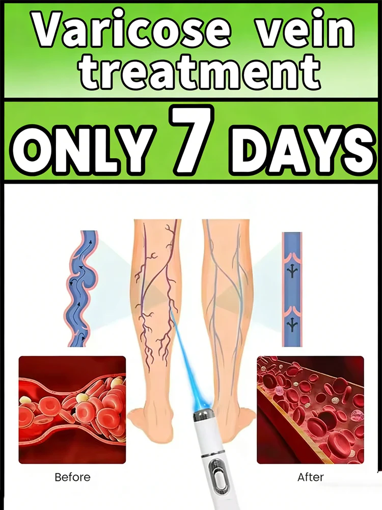 Leg care tools to eliminate leg problems, blue light therapy, home delivery.