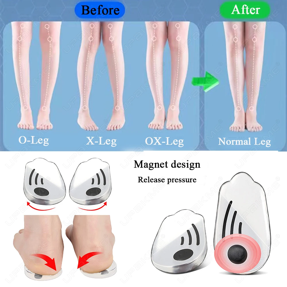 2Pcs Orthopedic O/X-type Legs Corrector Magnetic Silicone Insoles Valgus Varus Plantar Fasciitis Magnet Massage Foot Care Insole