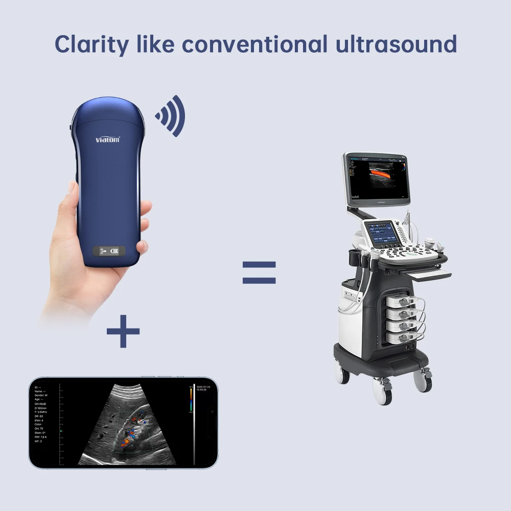 128 Elements Wireless Ultrasound Probe Linear/ Convex/ Phased Array 256 Level Image Gray Handheld Ultrasound Scanner