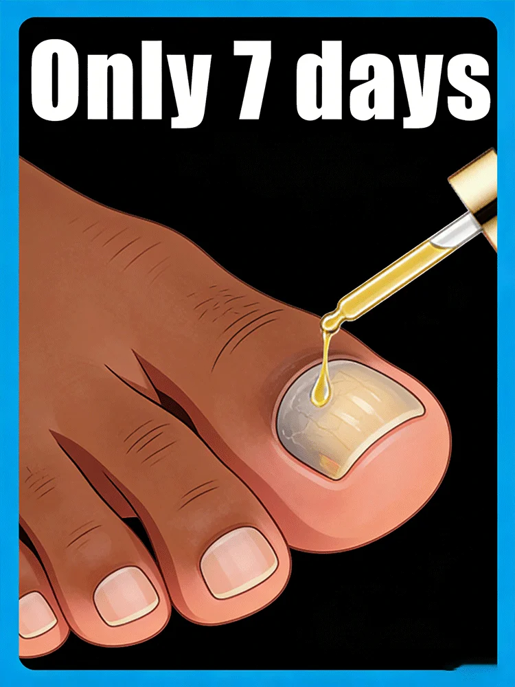 

Быстро устраняет грибок и восстанавливает здоровье ногтей ⴴунисекс