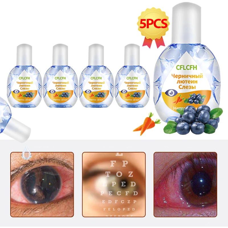 Cataract Treatment Eye Drops Blueberry Lutein for Cataract Cloudy Eyeball Dry Eyes Cure and Clear Vision  Russian Language