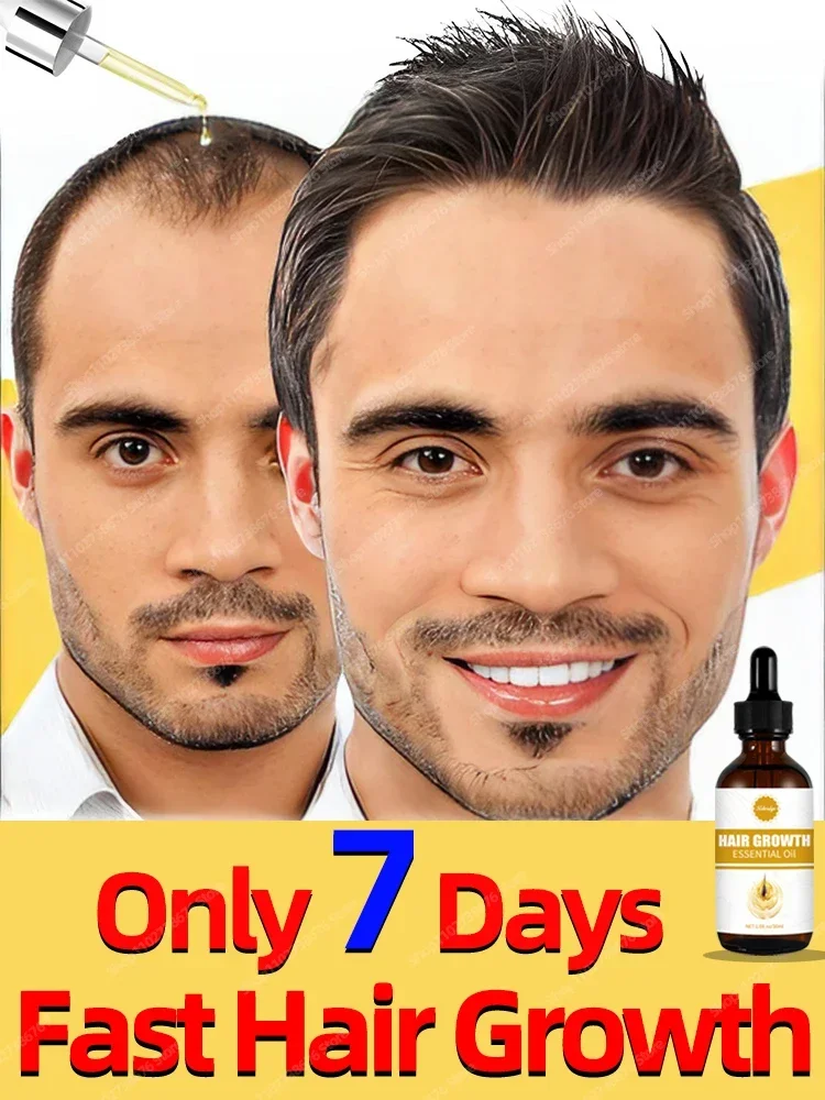 

O óleo de crescimento capilar faz o cabelo crescer rapidamente, repara eficazmente a calvície e a queda de cabelo hereditária