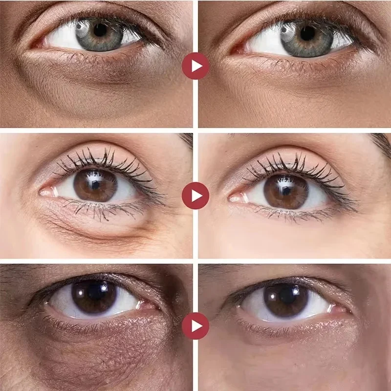 Máscara de colágeno para os olhos, removedor de rugas, remendos para os olhos, firmador, linhas finas, ácido hialurônico, hidratante, suave, cuidados com a pele dos olhos