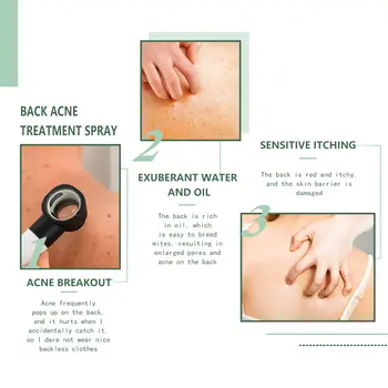 10 best sales Sırt sivilce spreyi - №9