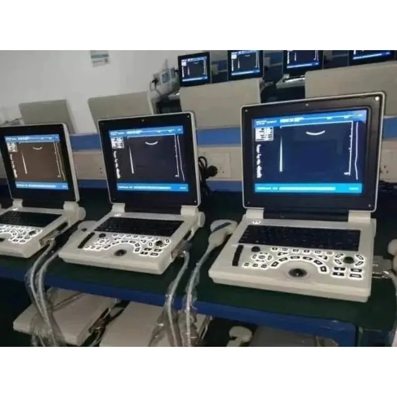 

Por Digital Scanner Convex Probe Laptop Operated Scanner Electricity Power Source