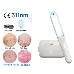 UVB 311nm Phototherapy Vitiligo Excimer Phototherapy Lamp UVB Treatment Of Psoriasis, Eczema, Pityriasis, Rose Spots