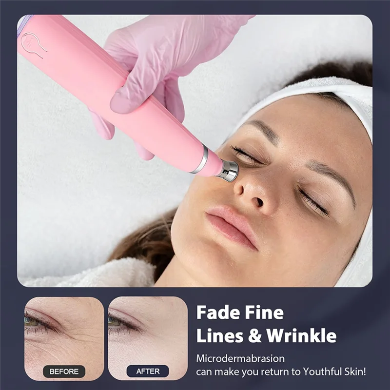 WHYY-Máquina peladora de diamantes portátil, microdermoabrasión, limpieza Facial, dispositivo de eliminación de espinillas, exfoliante de mano