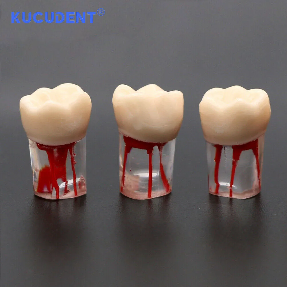 Kucurent 10 buah Endo gigi Model gigi, saluran akar endodontik blok latihan RCT Pulp rongga Resin studi pelatihan kedokteran gigi M8006