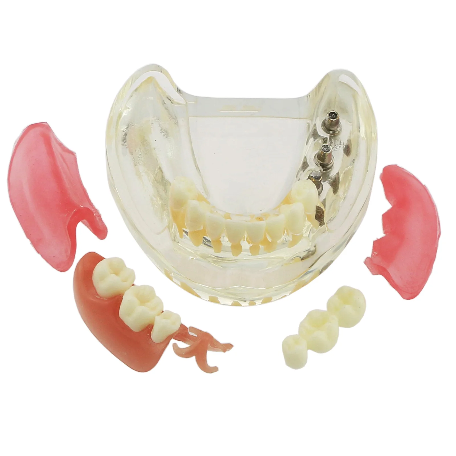 

Dental Demo Removable Bridge Implant Model Restoration Teeth Model Denture Demo M6006