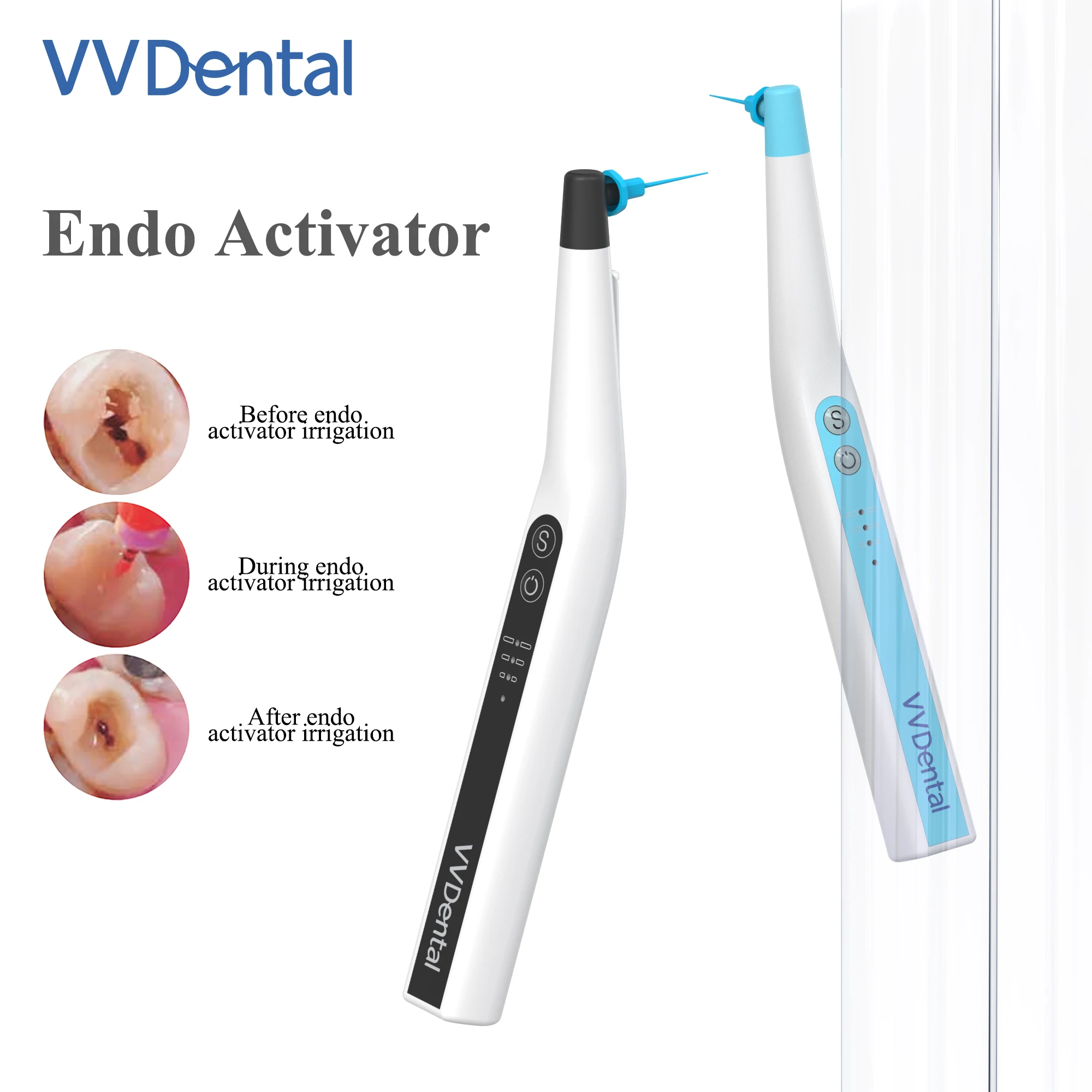 VVDental Ultrasonic Endo Activator With Lighted Handle Calcified Stain Endo Ntic Tool  For Root Canal Cleaning Sonic Irrigator
