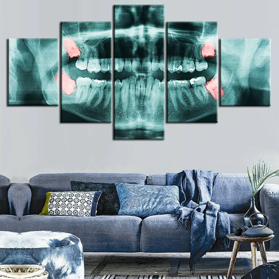 

No Framed 5 Pieces X-ray Full Teeth Dental Clinic Dentist Wall Art Canvas Posters Pictures Paintings Home Decor for Living Room