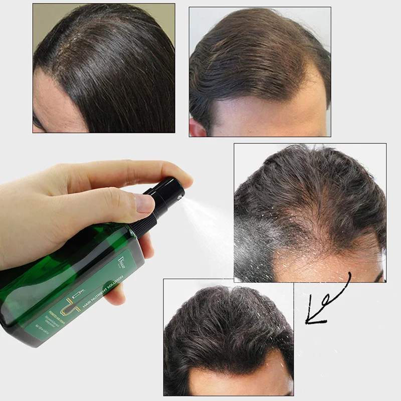 120ml Hair Shampoo Spray Prevent Baldness And Thinning Hair Promote Hair Growth Nourish Scalp Strengthening Treatment