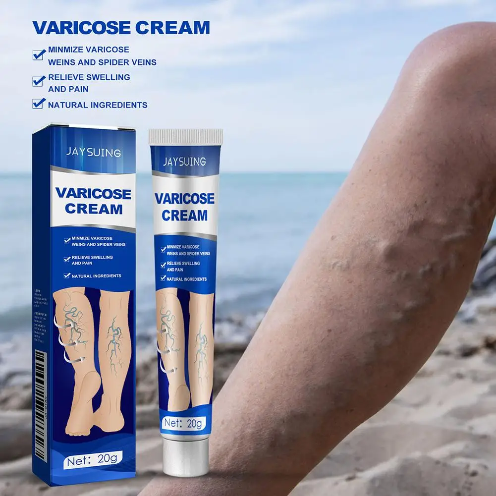 ointment for varicose veins Effective varicose vein relief cream to relieve Leg vasculitis phlebitis spider pain treatment L8P1