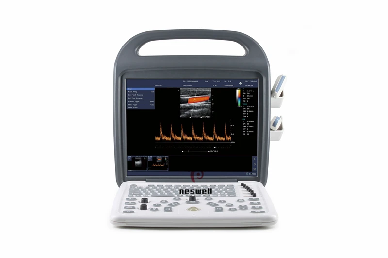 Economical 15 in LCD animal veterinary portable ultrasound color doppler scanner echo machine