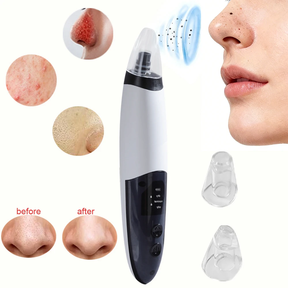 

Электрическое средство для удаления черных точек, портативное вакуумное средство для удаления пор, прыщей, чистка лица, носа, перезаряжаемые черные точки, удаление черных точек